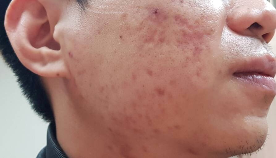 腎臟不好照鏡子有端倪？5種臉部變化恐是警訊 眼皮浮腫、面色暗沉都上榜 - 元氣網