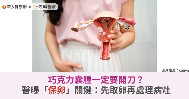 巧克力囊腫一定要開刀？醫曝「保卵」關鍵：先取卵再處理病灶