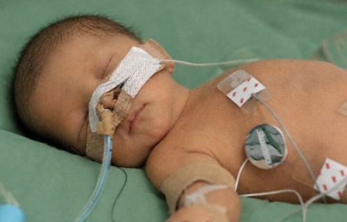 1歲兒遭保母打巴掌、捏肚子、摔下床撞頭！眼睛上吊、叫不醒，竟說「應該沒事」