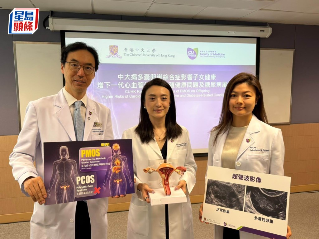 中大研究：多內分泌代謝性卵巢綜合症影響可傳至下一代 - Singtaousa