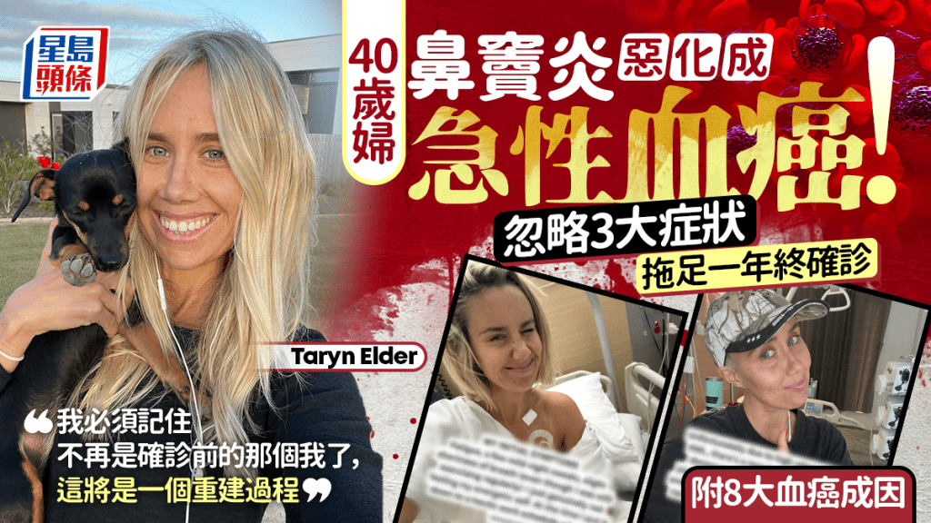 40歲婦鼻竇炎惡化成急性血癌！忽略3大症狀拖足一年終確診 附8大血癌成因 - singtao.ca