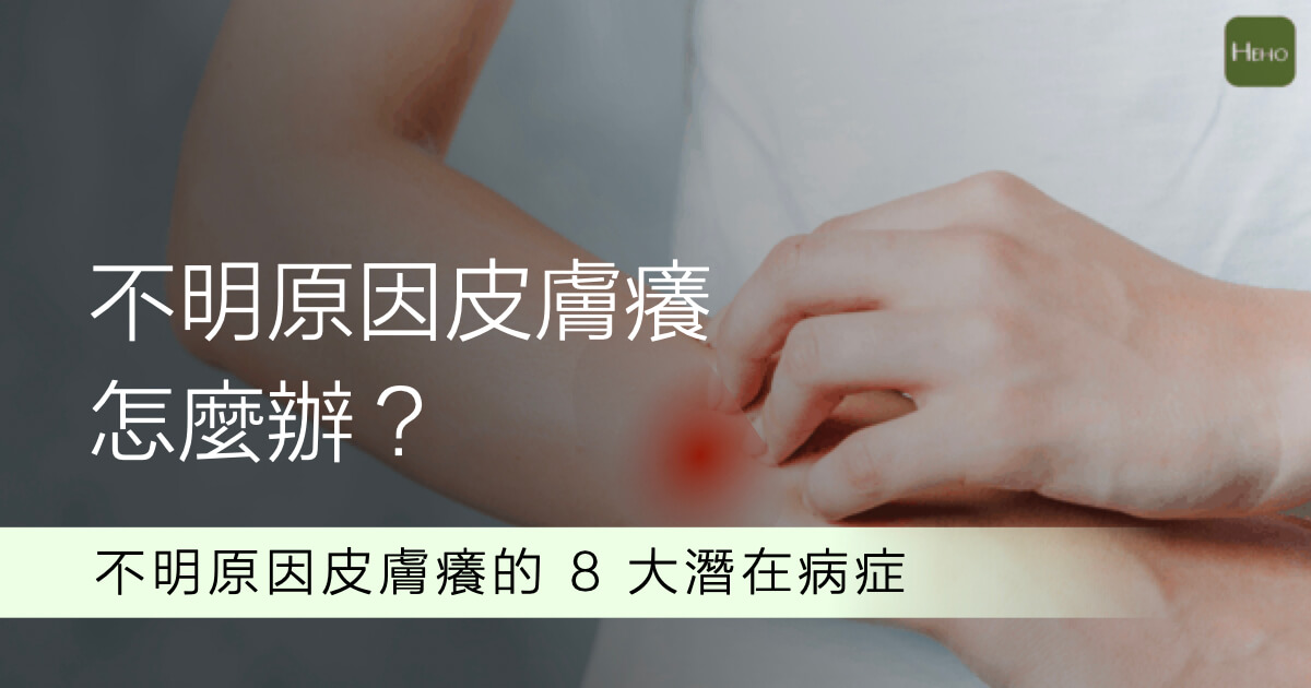 不明原因皮膚癢怎麼辦？當心是這 8 大潛在疾病警訊