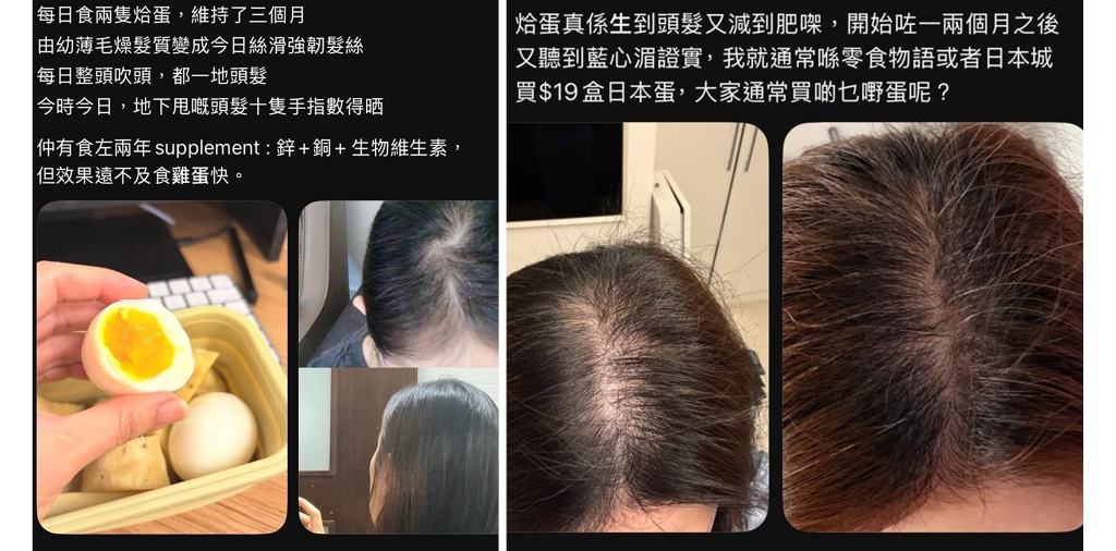 日日2隻蛋 3個月真係生到髮？原來要由毛囊深處激活！99%用家實證 KO脫髮、斷髮 - 晴報 Sky Post